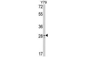 Image no. 1 for anti-CUE Domain Containing 2 (CUEDC2) (C-Term) antibody (ABIN452895) (CUEDC2 抗体  (C-Term))