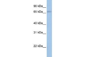 WB Suggested Anti-MAP3K2 Antibody Titration:  0. (MAP3K2 抗体  (N-Term))