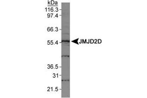 Western blot analysis of JMJD2D in HeLa nuclear extracts using JMJD2D polyclonal antibody . (JMJD2D 抗体  (AA 460-520))