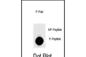 Dot blot analysis of anti-Phospho-LIN28- Phospho-specific Pab (ABIN650868 and ABIN2839816) on nitrocellulose membrane. (LIN28A 抗体  (pSer134))