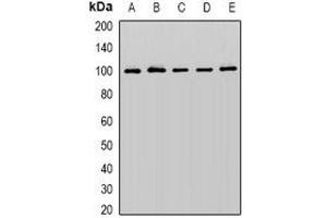 Western blot analysis of Cullin 5 expression in K562 (A), PC3 (B), SW480 (C), mouse brain (D), mouse heart (E) whole cell lysates. (Cullin 5 抗体)