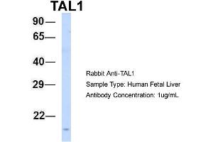 Host: Rabbit Target Name: TAL1 Sample Type: Human Fetal Liver Antibody Dilution: 1. (TAL1 抗体  (N-Term))