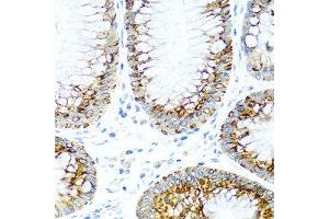 Immunohistochemistry of paraffin-embedded human colon using CCL2 antibody at dilution of 1:100 (40x lens). (CCL2 抗体)