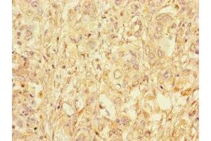 Immunohistochemistry (IHC) image for anti-Glucosidase, Alpha, Acid (GAA) (AA 601-952) antibody (ABIN7158768)