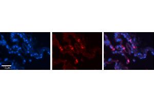 Rabbit Anti-HLA-F Antibody     Formalin Fixed Paraffin Embedded Tissue: Human Lung Tissue  Observed Staining: Membrane and cytoplasmic in alveolar type I cells  Primary Antibody Concentration: 1:100  Secondary Antibody: Donkey anti-Rabbit-Cy3  Secondary Antibody Concentration: 1:200  Magnification: 20X  Exposure Time: 0. (HLA-F 抗体  (N-Term))