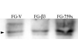 FG Pancreatic Carcinoma Cell stably expressing vector along (FG-V) the b3 integrin subunit (FG-b3) or a b3 truncation mutant (FG-759x). (Src 抗体  (pTyr215))