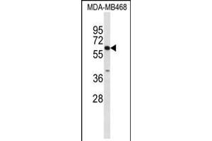 Western blot analysis of CES7 Antibody in MDA-MB468 cell line lysates (35ug/lane) (CES5A 抗体  (AA 244-270))