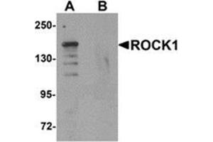 Western blot analysis of ROCK1 in 293 cell lysate with ROCK1 antibody at 1 μg/ml in (A) the absence and (B) the presence of blocking peptide. (ROCK1 抗体  (N-Term))