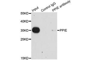 Immunoprecipitation analysis of 200 μg extracts of HeLa cells using 1 μg PPIE antibody (ABIN5975469). (PPIE 抗体)