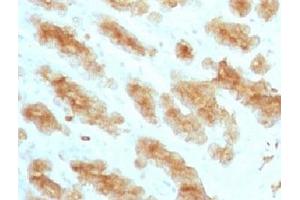 Formalin paraffin rat stomach with Acidic Cytokeratin antibody (KRTL/1077). (Keratin Acidic (AE1) 抗体)
