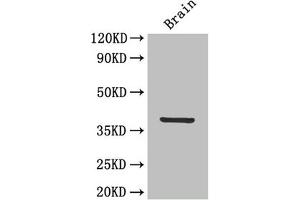 IL12B antibody  (AA 23-328)