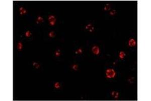 Immunofluorescence of AES in Hela cells with AES antibody at 20 µg/ml