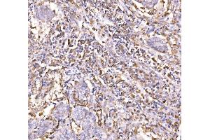 IHC analysis of Epac1/RAPGEF3 using anti-Epac1/RAPGEF3 antibody (ABIN7601858).