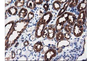 Immunohistochemical staining of paraffin-embedded Human liver tissue using anti-ALDH1L1 mouse monoclonal antibody. (ALDH1L1 抗体)