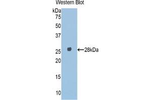 Western blot analysis of the recombinant protein. (A1BG 抗体  (AA 220-415))