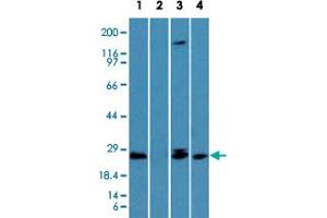 Western blot analysis of TICAM2 in the (Lane 1) absence and (Lane 2) presence of immunizing peptide in human lung, (Lane 3) mouse lung and (Lane 4) rat lung lysate using TICAM2 polyclonal antibody  at 1 ug/mL . (TICAM2 抗体  (AA 87-103))