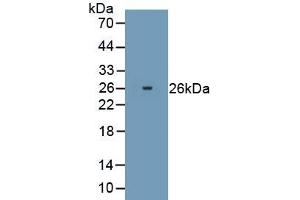 Detection of Recombinant PRDX2, Human using Polyclonal Antibody to Peroxiredoxin 2 (PRDX2) (Peroxiredoxin 2 抗体  (AA 2-198))