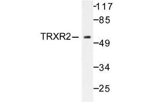 Image no. 1 for anti-Thioredoxin Reductase 2 (TXNRD2) antibody (ABIN271967) (TXNRD2 抗体)