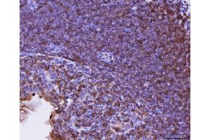 IHC analysis of Cxcr3 using anti-Cxcr3 antibody (ABIN7599273). (CXCR3 抗体  (AA 1-326))