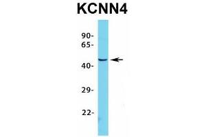 Western Blotting (WB) image for anti-Potassium Intermediate/small Conductance Calcium-Activated Channel, Subfamily N, Member 4 (KCNN4) (C-Term) antibody (ABIN2776147)