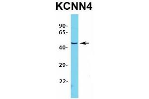 Host:  Rabbit  Target Name:  KCNN4  Sample Type:  HepG2  Antibody Dilution:  1. (KCNN4 抗体  (C-Term))