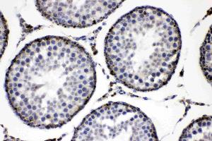 Immunohistochemistry (IHC) image for anti-Perilipin 2 (PLIN2) (AA 226-418) antibody (ABIN4886697)