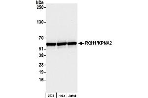 Western Blotting (WB) image for anti-Importin Subunit alpha-1 (KPNA2) (C-Term) antibody (ABIN7453571) (Importin Subunit alpha-1 (KPNA2) (C-Term) 抗体)