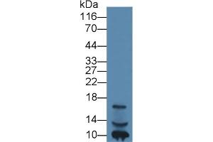 Detection of IGF1 in Human Lymphocyte lysate using Monoclonal Antibody to Insulin Like Growth Factor 1 (IGF1) (IGF1 抗体  (AA 49-118))