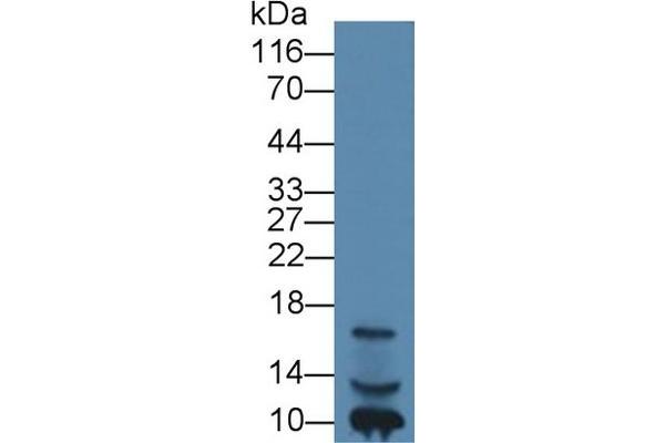 IGF1 抗体  (AA 49-118)