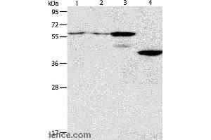 Western blot analysis of A375 and A172 cell, mouse pancreas tissue, human liver cancer tissue, using PGBD2 Polyclonal Antibody at dilution of 1:550 (PGBD2 抗体)