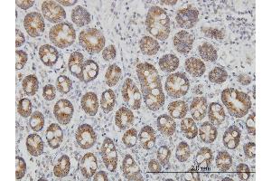 Immunoperoxidase of monoclonal antibody to TOMM20 on formalin-fixed paraffin-embedded human small Intestine. (TOMM20 抗体  (AA 1-145))