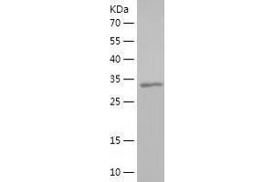 HCRTR1 Protein (AA 1-46, AA 244-297) (His-IF2DI Tag)
