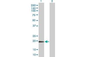 Western Blot analysis of TMEM134 expression in transfected 293T cell line by TMEM134 MaxPab polyclonal antibody. (TMEM134 抗体  (AA 1-195))