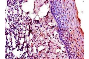 Immunohistochemistry of paraffin-embedded human tonsil tissue using ABIN7172803 at dilution of 1:100 (TACC3 抗体  (AA 133-268))