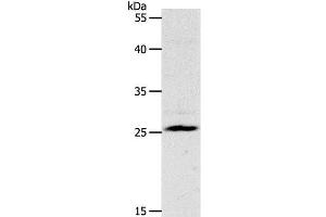 Western Blot analysis of Mouse liver tissue using NQO2 Polyclonal Antibody at dilution of 1:1200 (NQO2 抗体)