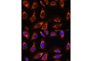 Immunofluorescence analysis of U-2 OS cells using RPL26 antibody (ABIN7269999) at dilution of 1:100. (RPL26 抗体  (AA 20-95))