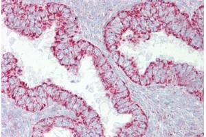 Anti-PDGFB antibody IHC staining of human uterus. (PDGF-BB Homodimer (N-Term) 抗体)