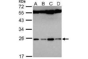 WB Image Sample (30 ug of whole cell lysate) A: Hela B: Hep G2 , C: Molt-4 , D: Raji 12% SDS PAGE antibody diluted at 1:5000 (FAM9B 抗体)