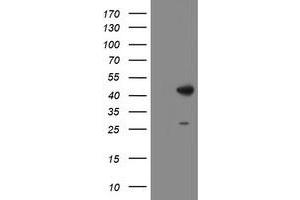 Western Blotting (WB) image for anti-Dihydrolipoamide Branched Chain Transacylase E2 (DBT) antibody (ABIN1497771) (DBT 抗体)