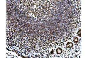 IHC analysis of SORBS3 using anti-SORBS3 antibody (ABIN7603121).