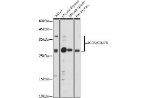 Western blot analysis of extracts of various cell lines, using ICOS/CD278 antibody (ABIN3022590, ABIN3022591, ABIN3022592, ABIN1513055 and ABIN6218929) at 1:500 dilution.