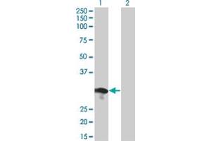 Western Blot analysis of RABL2B expression in transfected 293T cell line by RABL2B monoclonal antibody (M01), clone 1B10. (RABL2B 抗体  (AA 1-229))