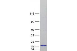 Validation with Western Blot