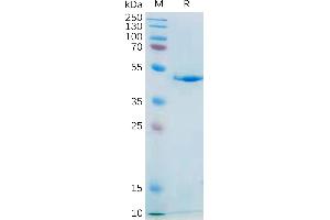 Human IL21 Protein, mFc Tag on SDS-PAGE under reducing condition.