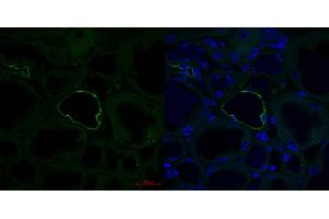 Mouse kidney (AQP2 抗体  (Middle Region))