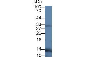 Western Blot; Sample: Human Leukocyte lysate; Primary Ab: 3µg/ml Mouse Anti-Human RANkL Antibody Second Ab: 0. (RANKL 抗体  (AA 106-240))