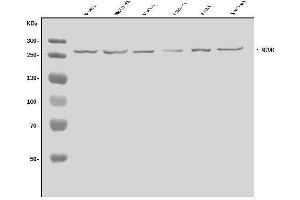 Western blot analysis of MTOR using anti-MTOR antibody (ABIN6719566).