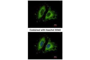 ICC/IF Image Immunofluorescence analysis of methanol-fixed HeLa, using GIT1, antibody at 1:500 dilution. (GIT1 抗体  (Internal Region))