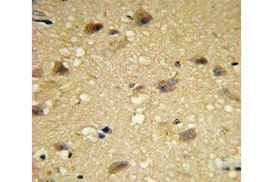 IHC analysis of FFPE human brain tissue with CCL2 antibody (CCL2 抗体  (AA 62-89))
