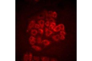 Immunofluorescent analysis of BOC staining in SW480 cells. (BOC 抗体)
